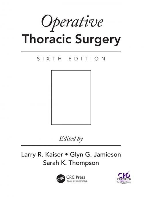 Cover of the book Operative Thoracic Surgery by , CRC Press