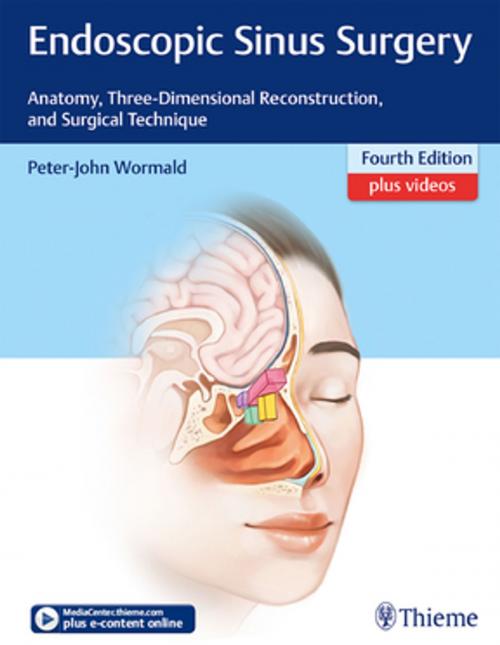 Cover of the book Endoscopic Sinus Surgery by Peter J. Wormald, Thieme