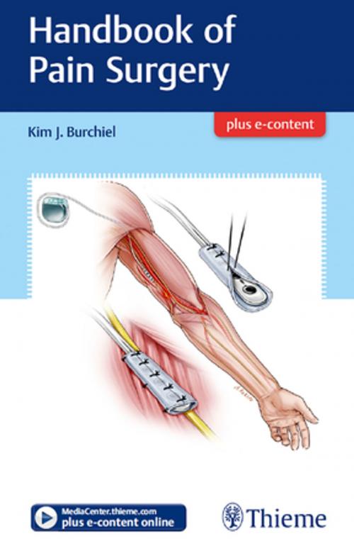 Cover of the book Handbook of Pain Surgery by Kim J. Burchiel, Thieme