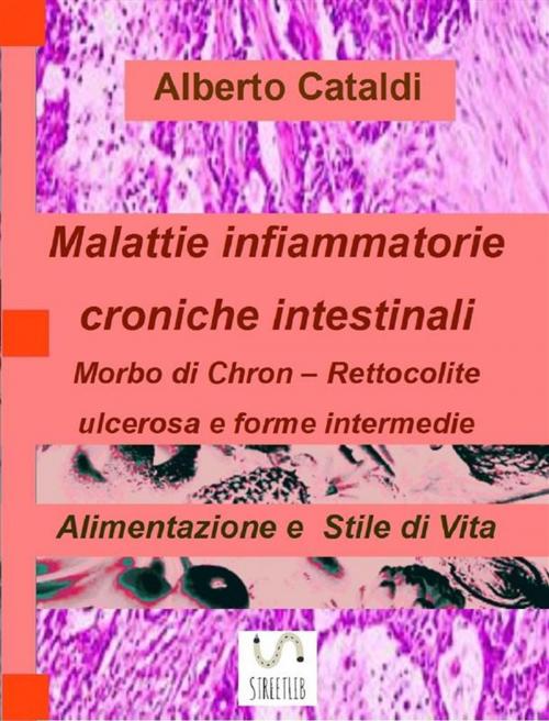 Cover of the book Malattie Infiammatorie Croniche Intestinali by Alberto Cataldi, Publisher s19019