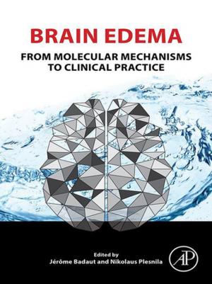 Cover of the book Brain Edema by Edward Halibozek, Gerald L. Kovacich, CFE, CPP, CISSP