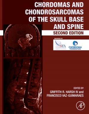 Cover of the book Chordomas and Chondrosarcomas of the Skull Base and Spine by Ted J Trauner Jr.