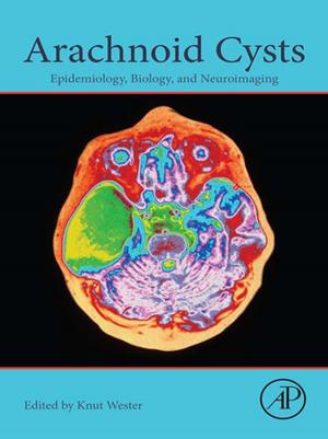 Cover of the book Arachnoid Cysts by Keng C. Wu