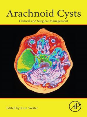 Cover of the book Arachnoid Cysts by Peter M. Miller