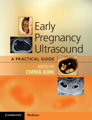 Cover of the book Early Pregnancy Ultrasound by Silvana R. Siddali