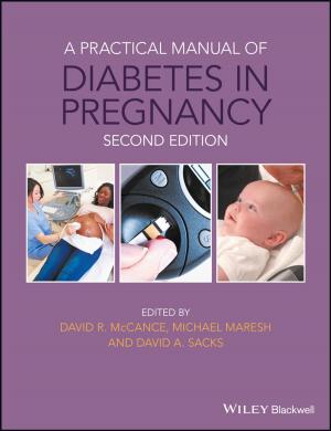 Cover of the book A Practical Manual of Diabetes in Pregnancy by Laura Cruz