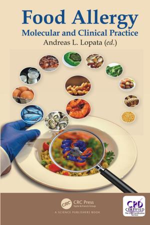 Cover of the book Food Allergy by Vadim Backman, Adam Wax, Hao F. Zhang
