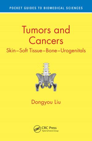 Cover of the book Tumors and Cancers by Anoop Desai, Aashi Mital