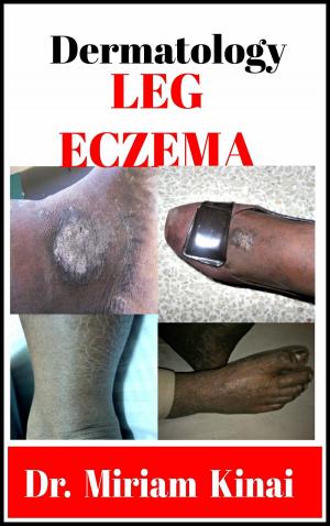 Book cover of Dermatology: Leg Eczema
