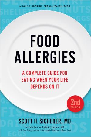 Cover of the book Food Allergies by David Hochfelder