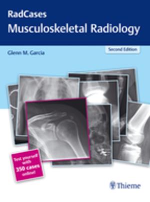 Cover of the book Radcases Musculoskeletal Radiology by 