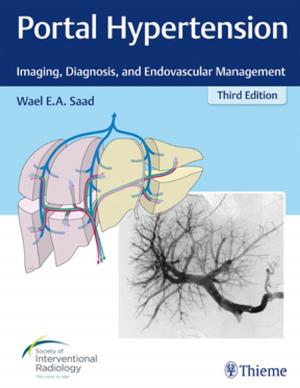 Book cover of Portal Hypertension
