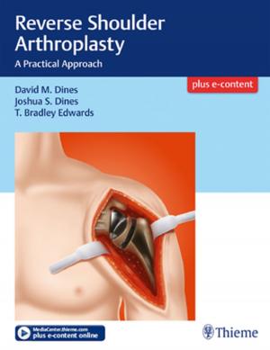 Cover of the book Reverse Shoulder Arthroplasty by Charles James, Charles M. Glasier, Bruce S. Greenberg