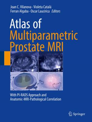 bigCover of the book Atlas of Multiparametric Prostate MRI by 