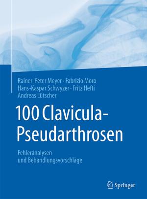 Book cover of 100 Clavicula-Pseudarthrosen