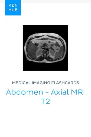 Book cover of Medical Imaging flashcards: Abdomen - Axial MRI T2