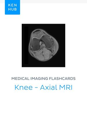Cover of Medical Imaging flashcards: Knee - Axial MRI