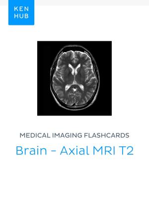 Book cover of Medical Imaging flashcards: Brain - Axial MRI T2