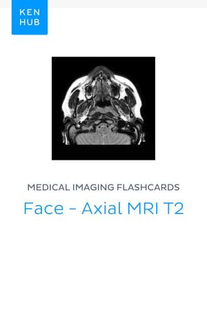 Book cover of Medical Imaging flashcards: Face - Axial MRI T2