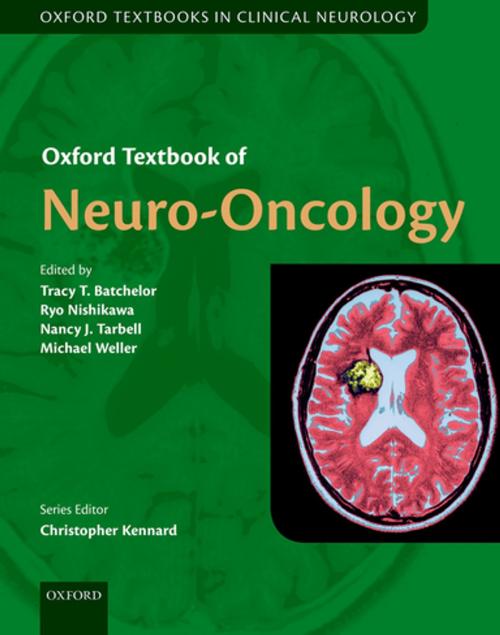Cover of the book Oxford Textbook of Neuro-Oncology by , OUP Oxford