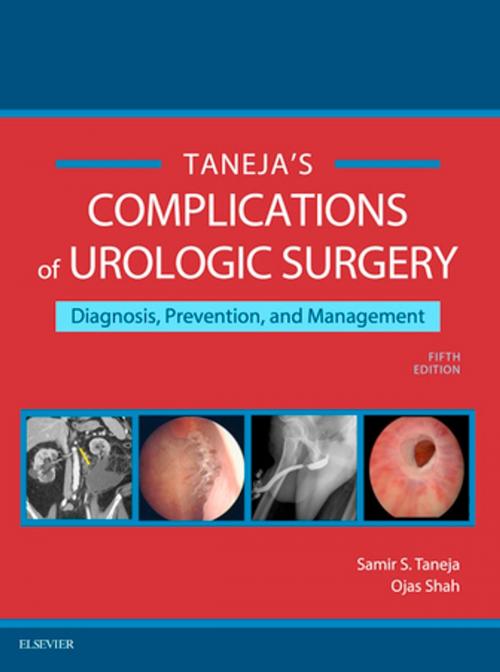 Cover of the book Complications of Urologic Surgery E-Book by Samir S. Taneja, MD, Ojas Shah, MD, Elsevier Health Sciences