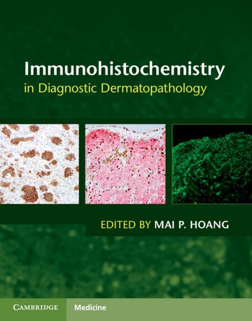 Cover of the book Immunohistochemistry in Diagnostic Dermatopathology by , Cambridge University Press