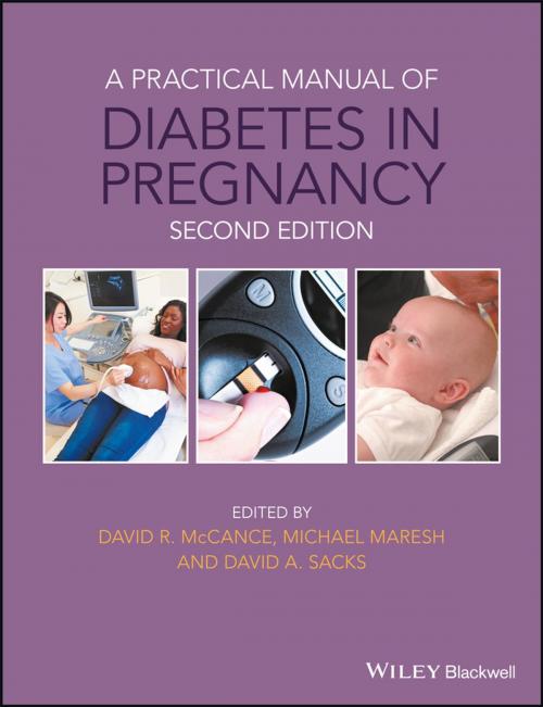 Cover of the book A Practical Manual of Diabetes in Pregnancy by , Wiley