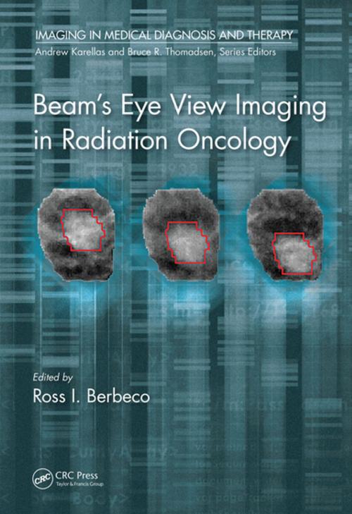Cover of the book Beam's Eye View Imaging in Radiation Oncology by , CRC Press