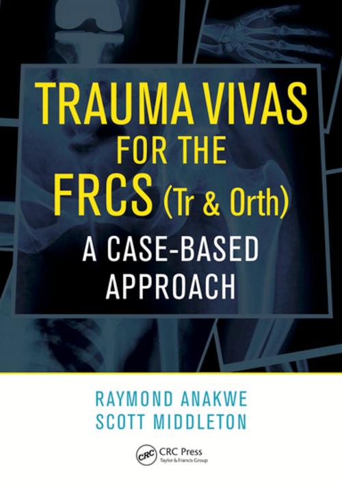 Cover of the book Trauma Vivas for the FRCS by Raymond Anakwe, Scott Middleton, CRC Press