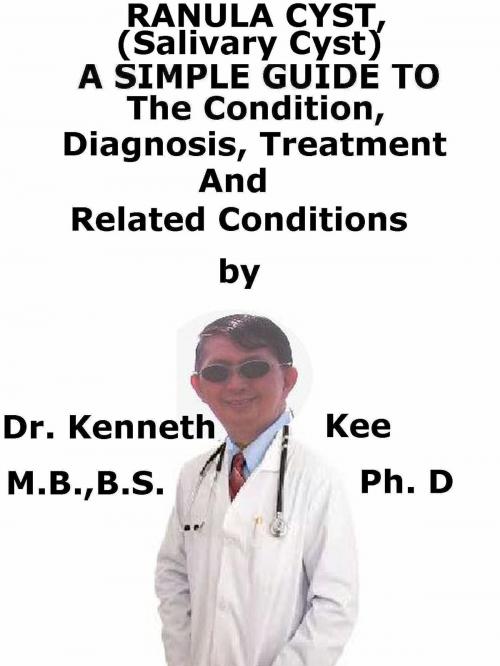 Cover of the book Ranula Cyst, (Salivary Cyst) A Simple Guide To The Condition, Diagnosis, Treatment And Related Conditions by Kenneth Kee, Kenneth Kee