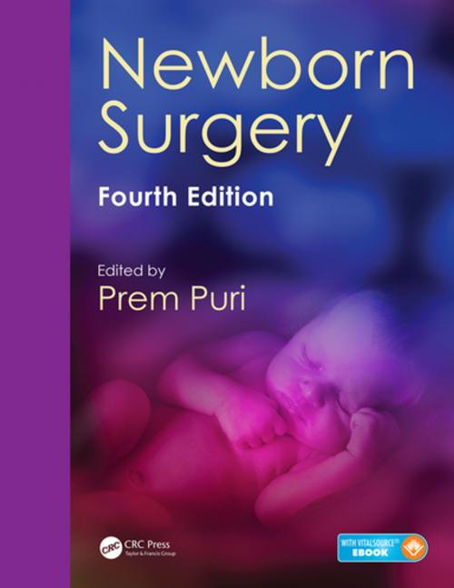 Cover of the book Newborn Surgery by , CRC Press