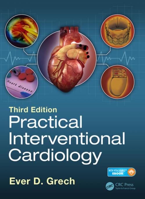 Cover of the book Practical Interventional Cardiology by , CRC Press