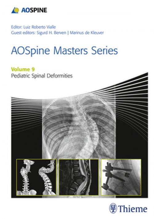 Cover of the book AOSpine Masters Series, Volume 9: Pediatric Spinal Deformities by , Thieme
