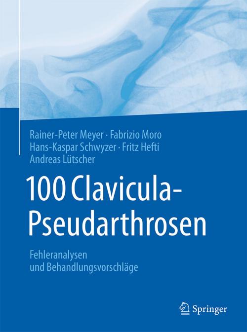 Cover of the book 100 Clavicula-Pseudarthrosen by Rainer-Peter Meyer, Fabrizio Moro, Hans-Kaspar Schwyzer, Fritz Hefti, Springer Berlin Heidelberg