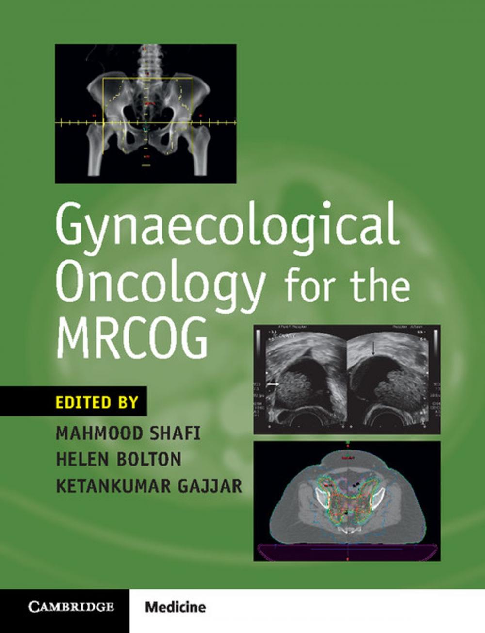 Big bigCover of Gynaecological Oncology for the MRCOG