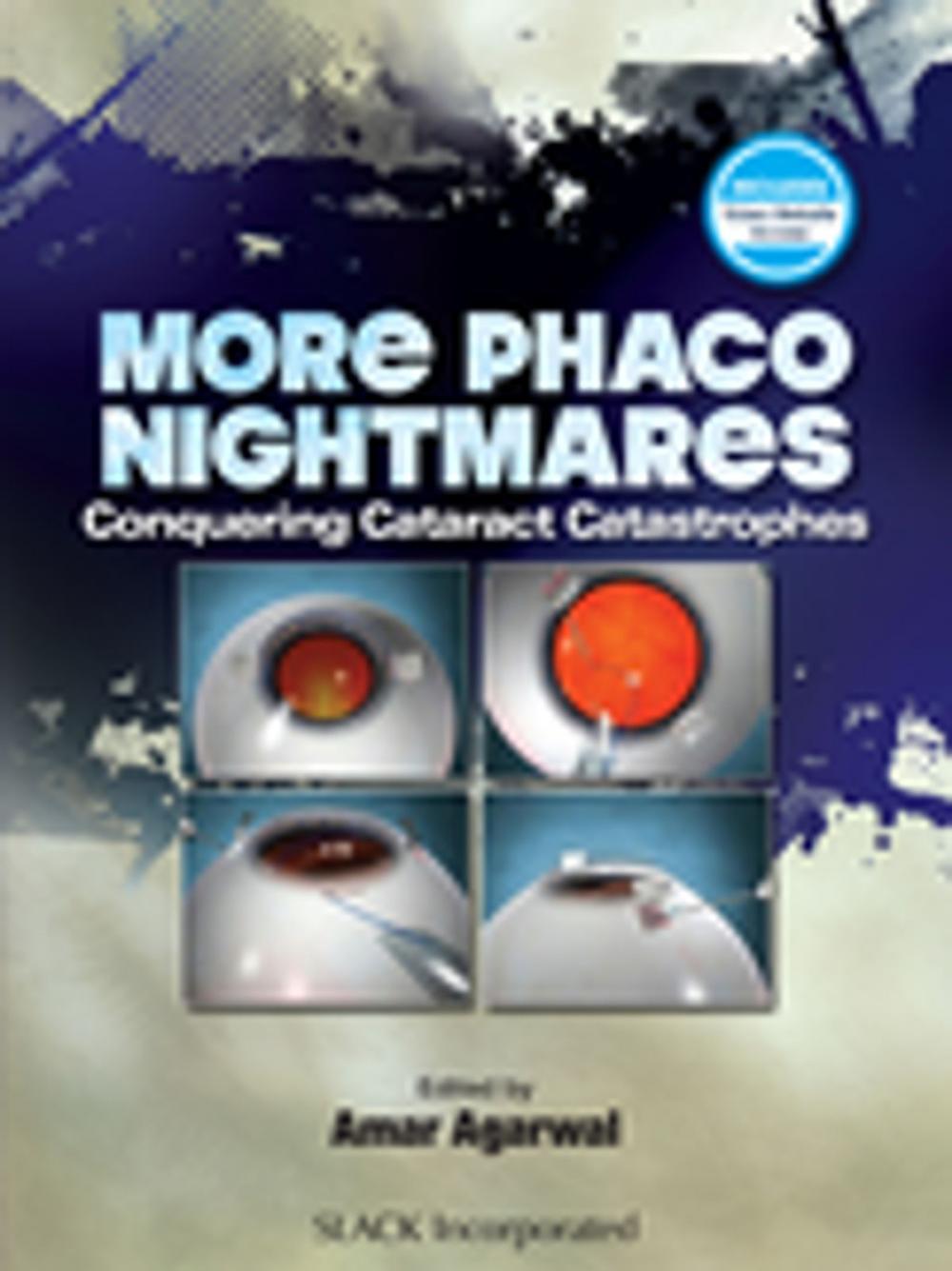 Big bigCover of More Phacoo Nightmares