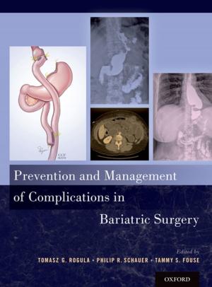 bigCover of the book Prevention and Management of Complications in Bariatric Surgery by 