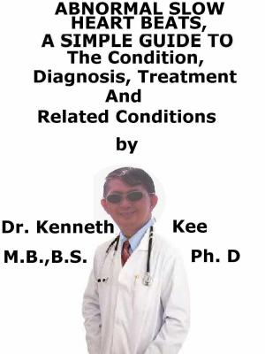 Cover of the book Abnormal Slow Heart Beats, A Simple Guide To The Condition, Diagnosis, Treatment And Related Conditions by Kenneth Kee