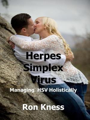 bigCover of the book Herpes Simplex Virus by 