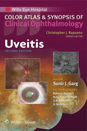 Cover of the book Uveitis by Vincent T. DeVita, Theodore S. Lawrence, Steven A. Rosenberg