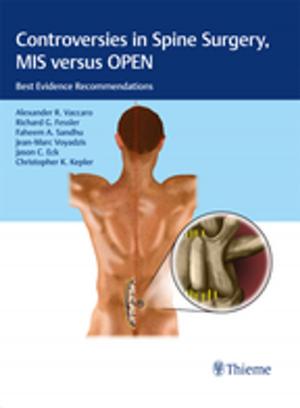 Cover of the book Controversies in Spine Surgery, MIS versus OPEN by Homayoun Tabandeh, Morton F. Goldberg