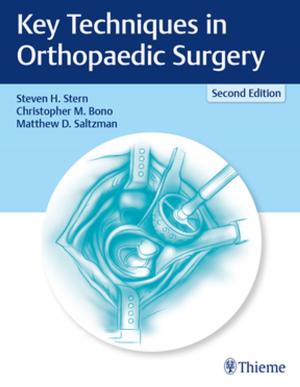 Book cover of Key Techniques in Orthopaedic Surgery