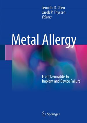 Cover of the book Metal Allergy by Tom Vander Beken
