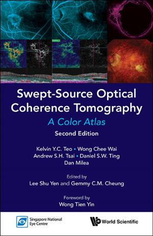 Book cover of Swept-Source Optical Coherence Tomography