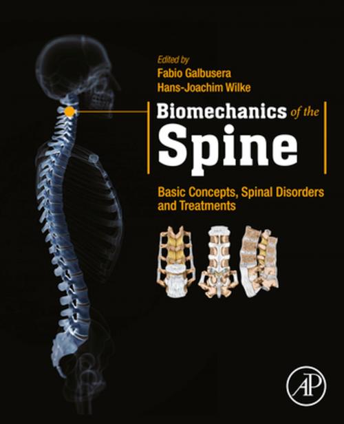 Cover of the book Biomechanics of the Spine by , Elsevier Science