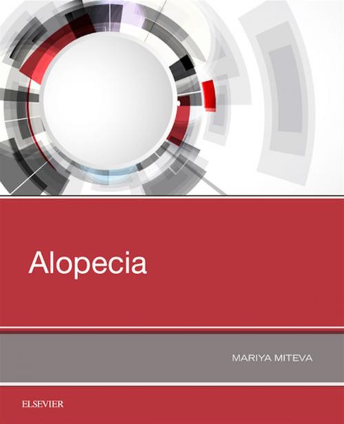 Cover of the book Alopecia by Mariya I Miteva, Elsevier Health Sciences