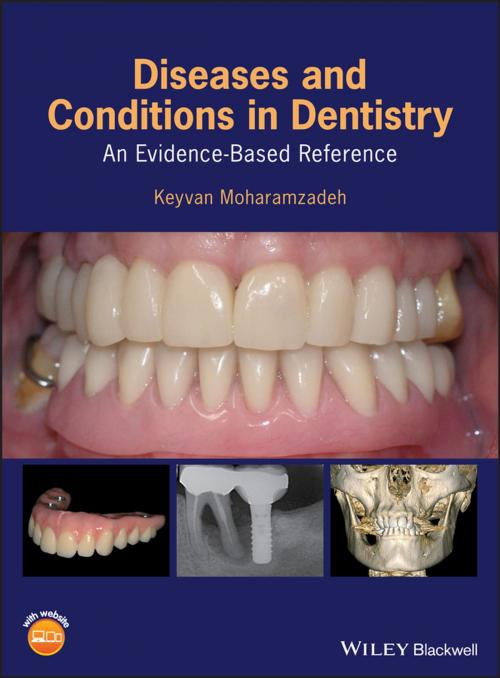 Cover of the book Diseases and Conditions in Dentistry by Keyvan Moharamzadeh, Wiley