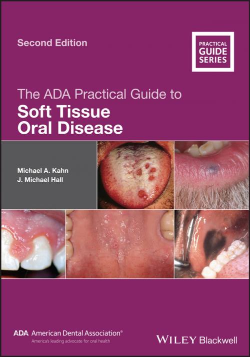 Cover of the book The ADA Practical Guide to Soft Tissue Oral Disease by Michael A. Kahn, J. Michael Hall, Wiley