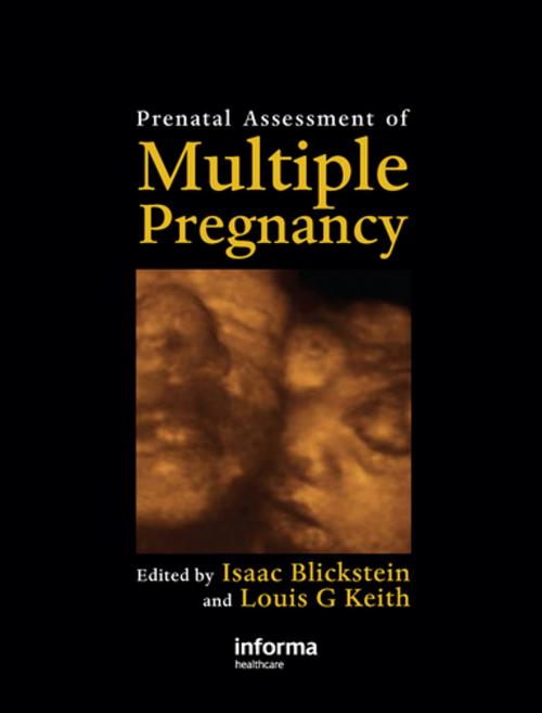 Cover of the book Prenatal Assessment of Multiple Pregnancy by , CRC Press