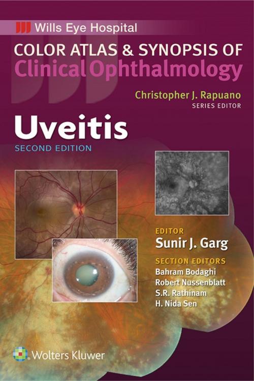 Cover of the book Uveitis by Sunir J. Garg, Wolters Kluwer Health